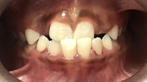 DDs6-EXo38-Kt3-Hht-Qj-Erde-G9-U8433cq-Sa.jpg