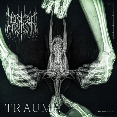 Nos-eep-Trauma-2025-FLAC-16bit-44-1k-Hz.jpg